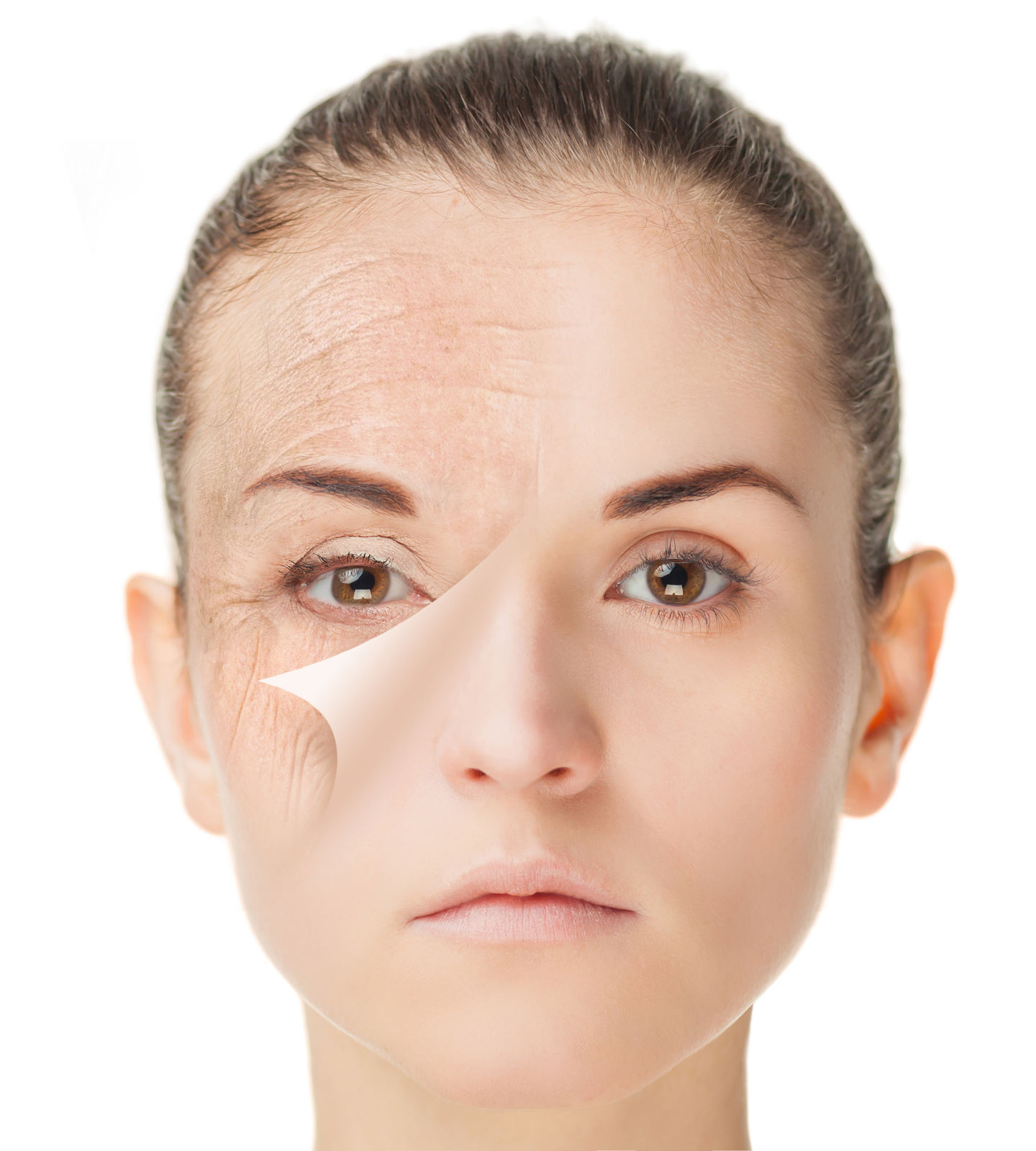 Skin care treatment before and after, rejuvenation procedure